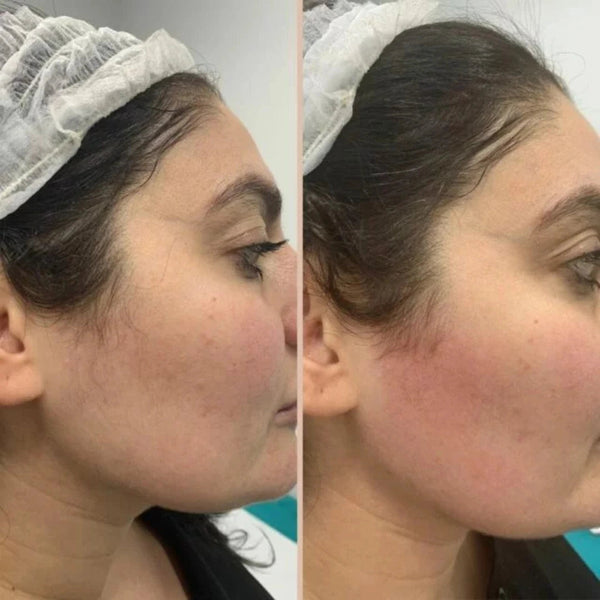 Customer before and after result
