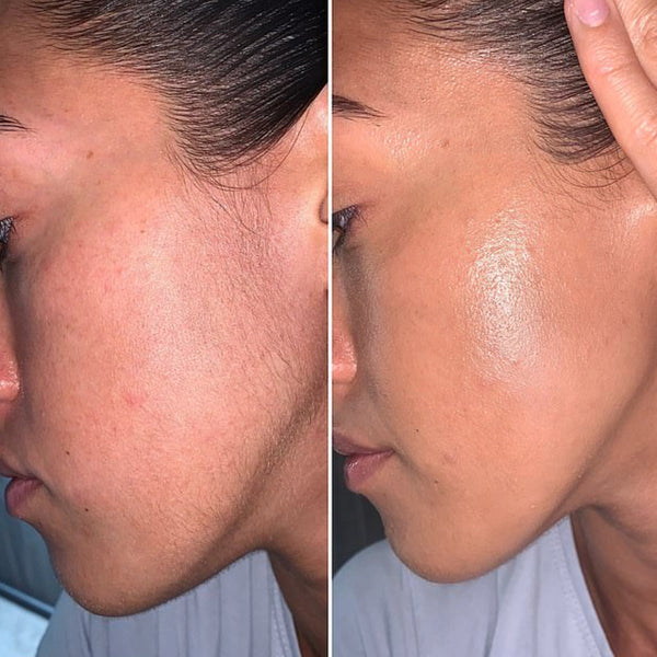 Customer before and after result